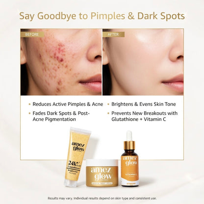 Amez Glow Pimple & Pigmentation Kit
