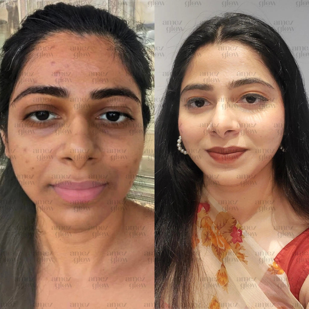 Amezglow Beauty Kit – Get Clear, Fair & Glowing Skin Naturally