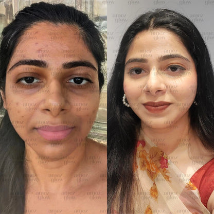 Amezglow Beauty Kit – Get Clear, Fair & Glowing Skin Naturally