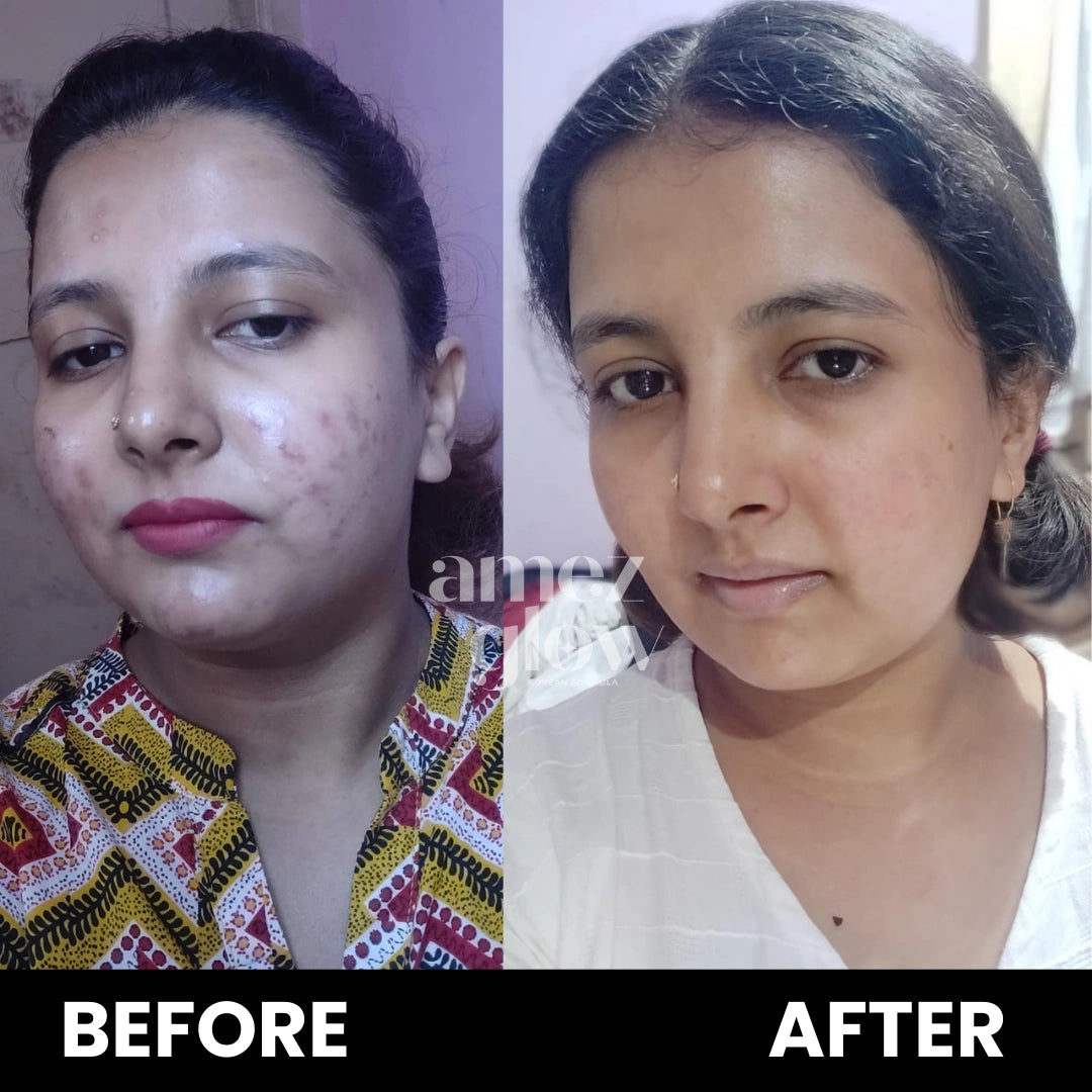 Skin Rejuvenating Routine ( KIT )