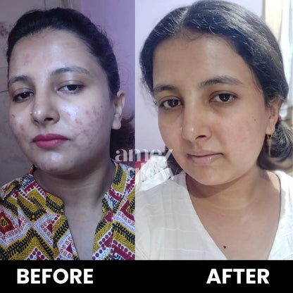 Skin Rejuvenating Routine ( KIT )