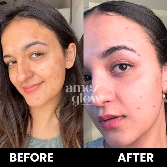 Skin Rejuvenating Routine ( KIT )