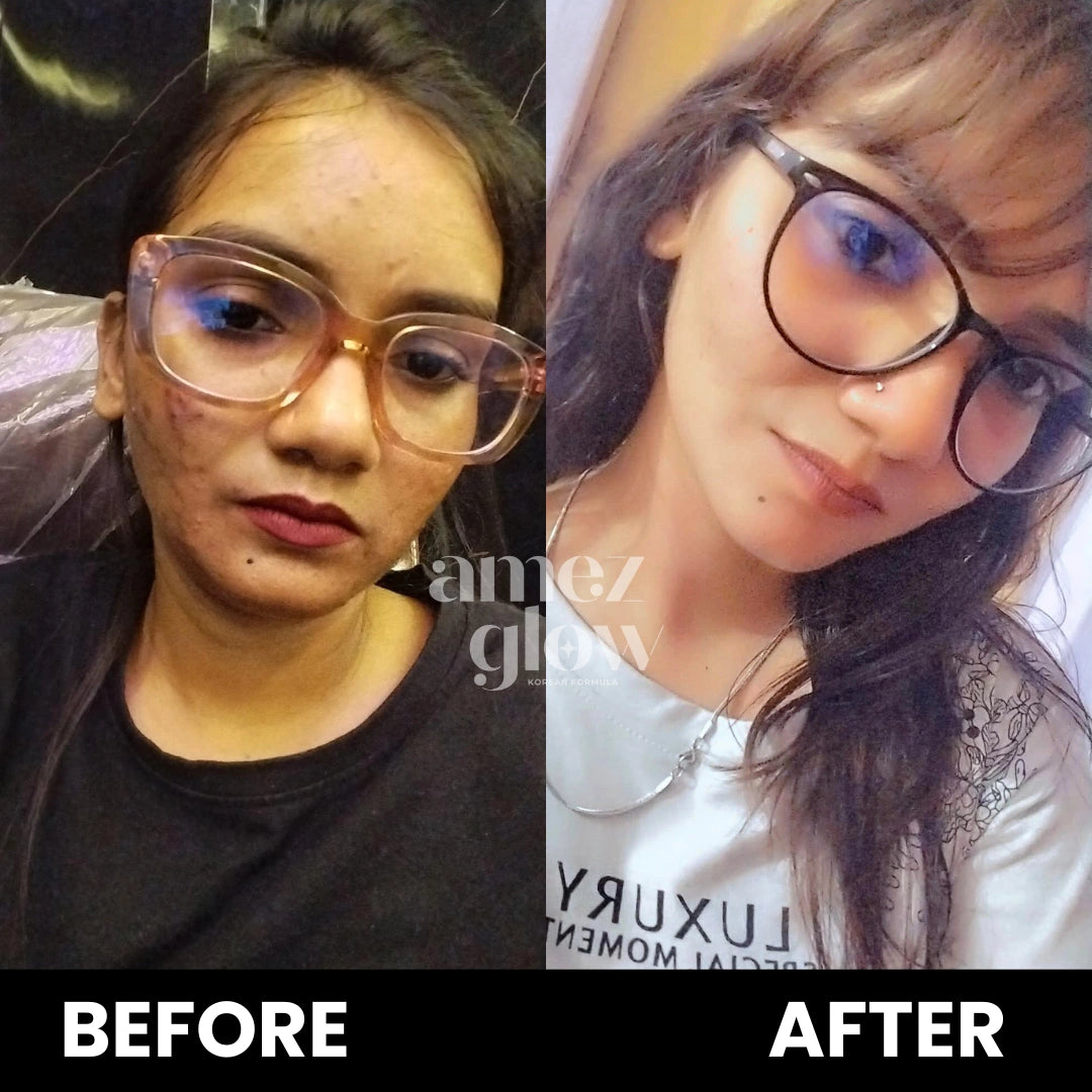 Daily Glow Routine (cream & Facewash)