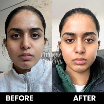 Skin Rejuvenating Routine ( KIT )