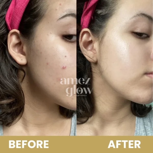 MAGICAL COMBO ( Magical Cream + Face wash) - Image 6