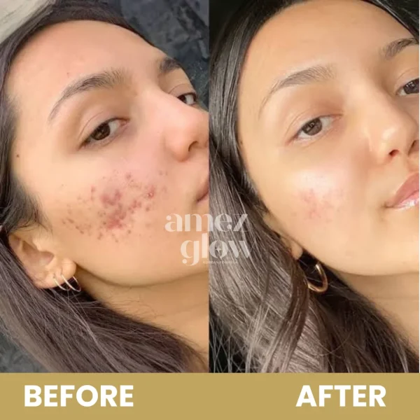 MAGICAL COMBO ( Magical Cream + Face wash) - Image 8