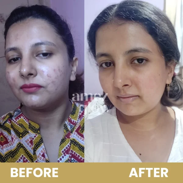 MAGICAL COMBO ( Magical Cream + Face wash) - Image 7