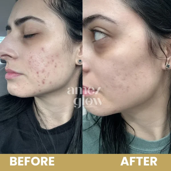 AMEZ GLOW MAGICAL NIGHT CREAM FOR FACE - Image 9